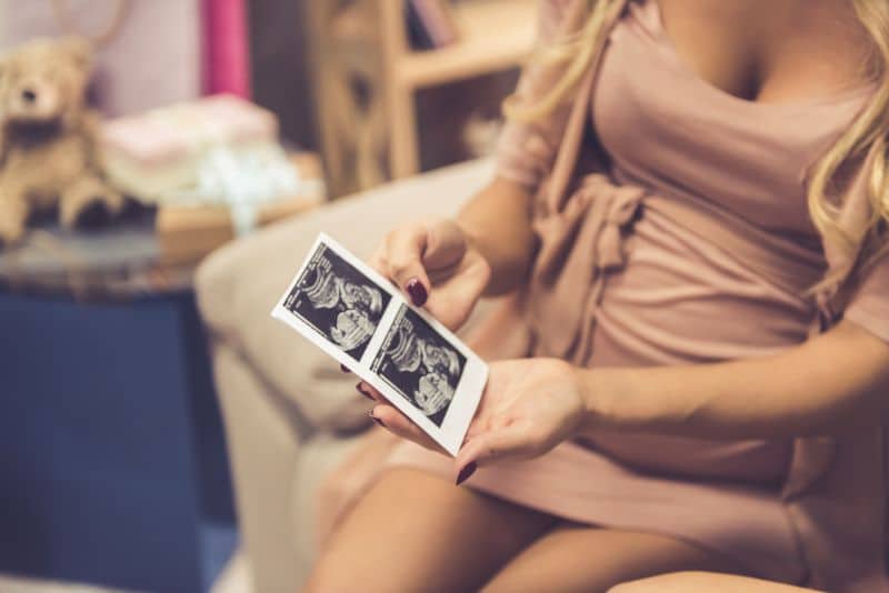 woman showing off ultrasound picture