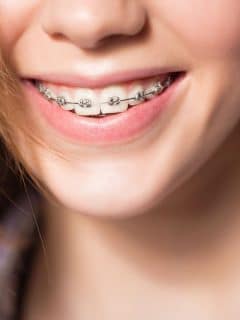 teen girl with braces smiling